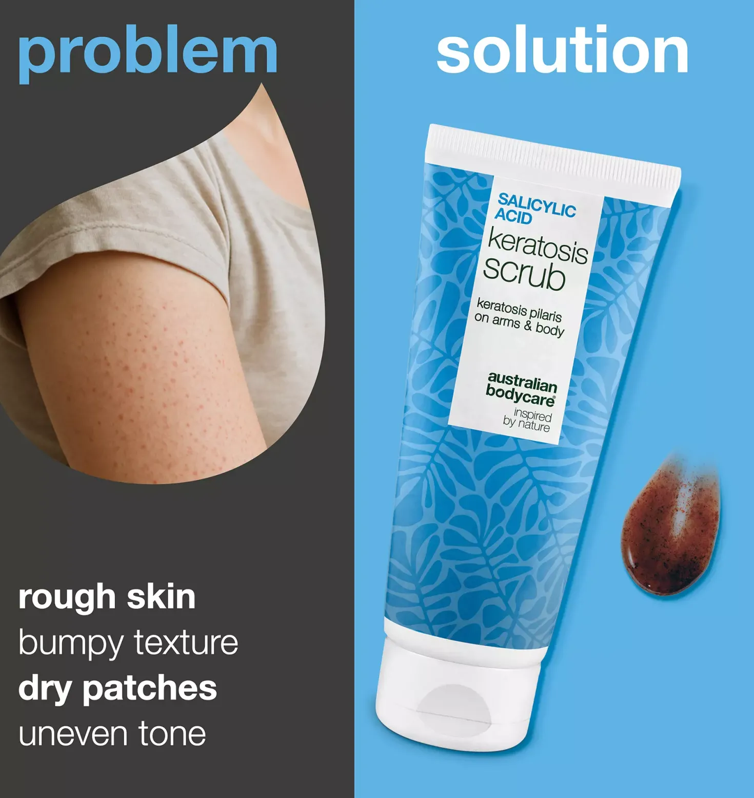 Australian Bodycare Salicylic Acid Keratosis Scrub 200 ml
