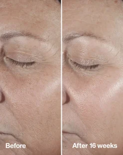 CliniqueSmart Clinical Repair Clinical Repair Wrinkle Correcting Serum 50 ml