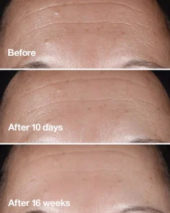 CliniqueSmart Clinical Repair Clinical Repair Wrinkle Correcting Serum 50 ml