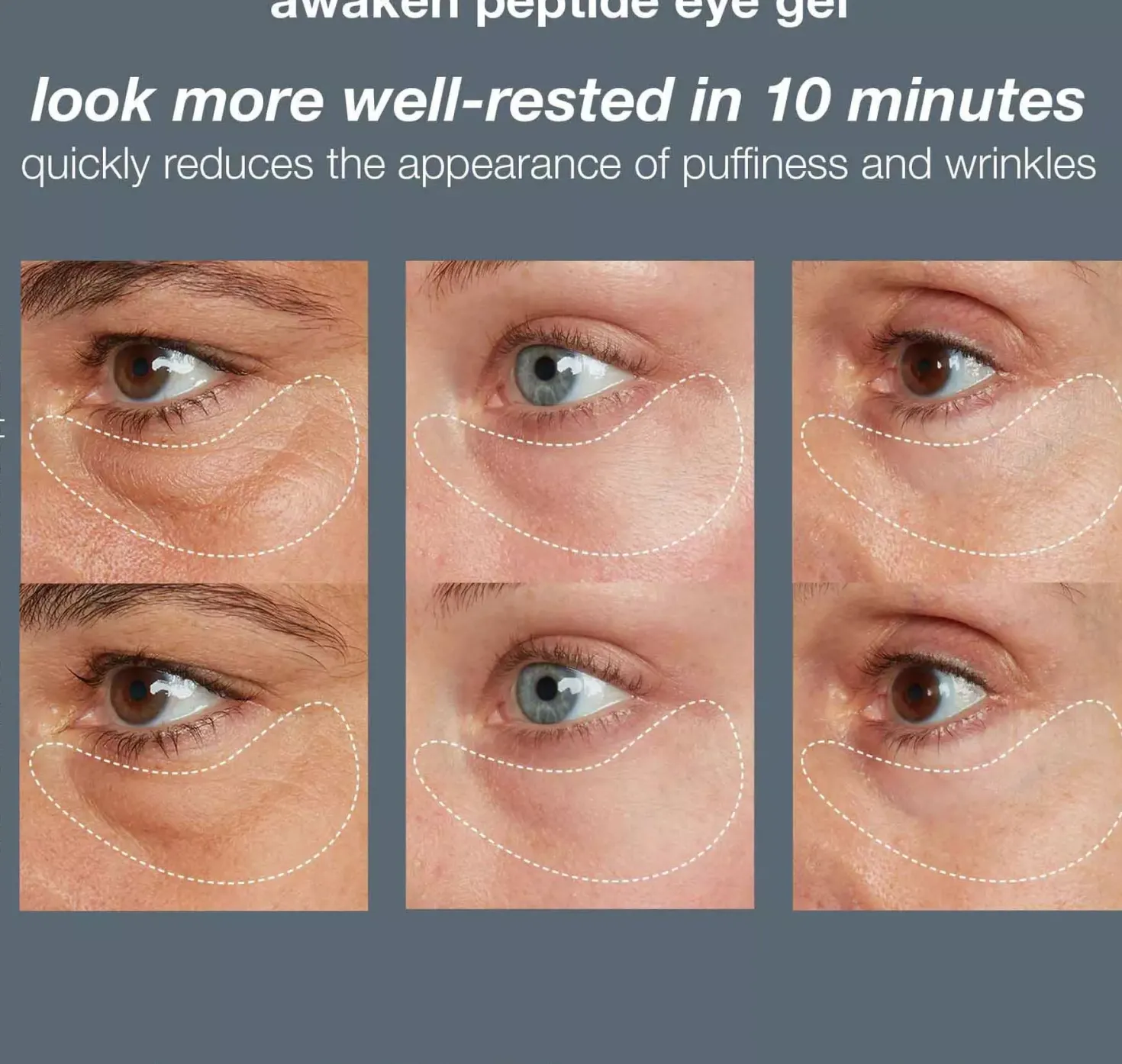 Dermalogica Awaken Peptide Eye Gel 15 ml
