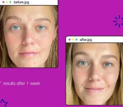DermalogicaClear Start Post-Breakout Fix 15 ml