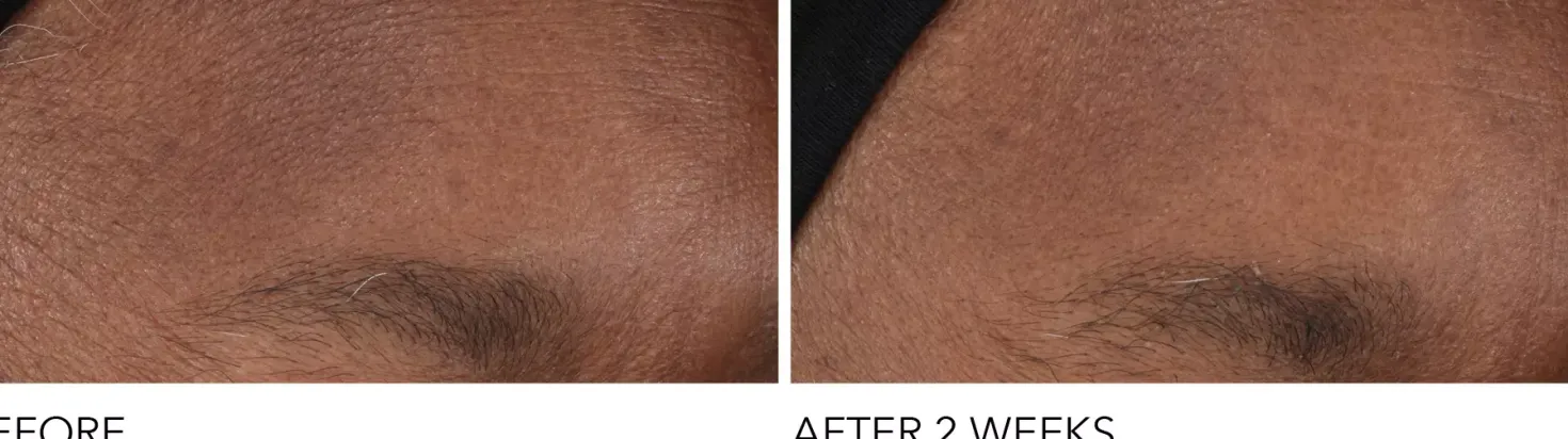 Dr Dennis Gross Advanced Retinol + Ferulic Overnight Wrinkle Treatment 30 ml