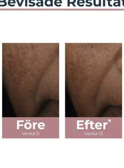EucerinAnti-Pigment Spot Corrector 5 ml