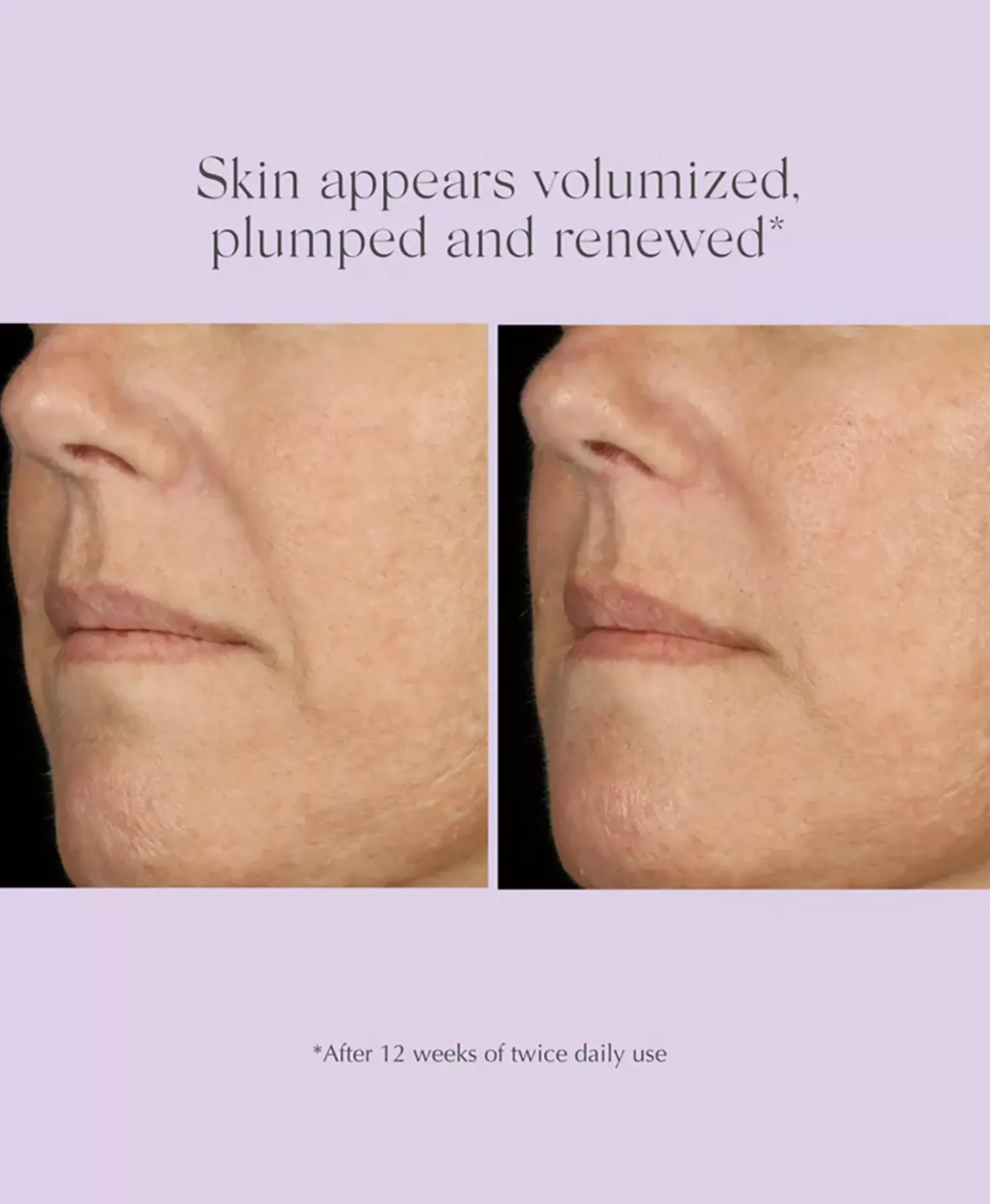Exuviance Age Reverse Total Correct + Sculpt Serum 30 ml