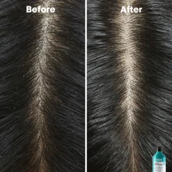 L'Oréal ProfessionnelScalp Advanced Professional Shampoo 300 ml