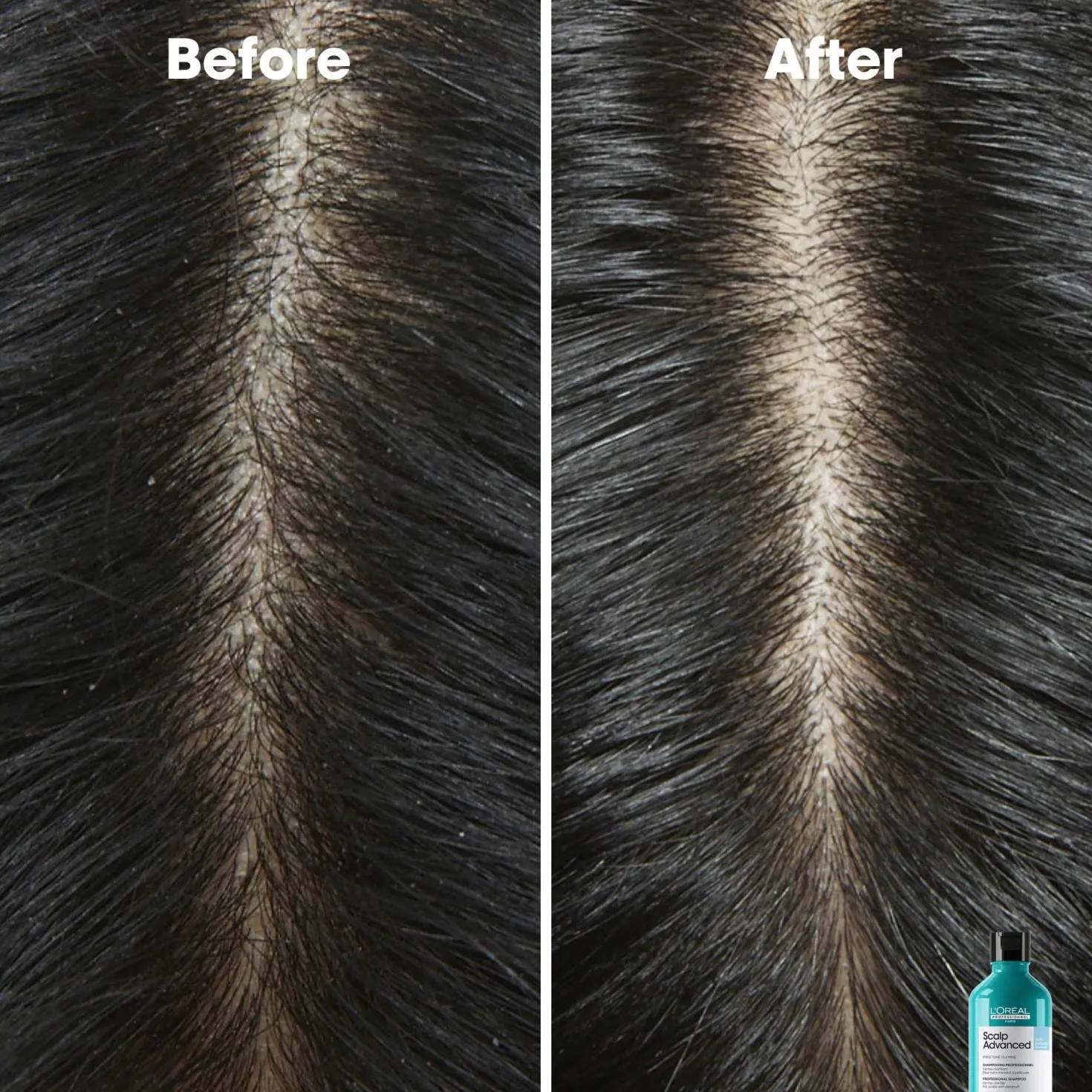 L'Oréal ProfessionnelScalp Advanced Professional Shampoo 300 ml