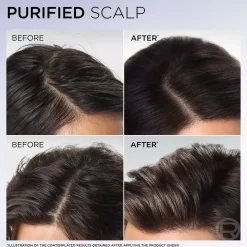 Loreal ParisElvital Hyaluron Pure Purifying Shampoo 500 ml