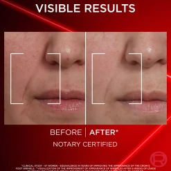Loreal ParisRevitalift Laser Triple Action Anti-Ageing Day Cream 50 ml