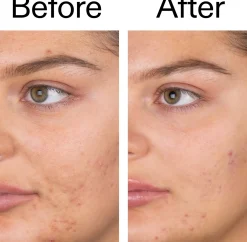 The Inkey List Salicylic Acid Cleanser 60 ml