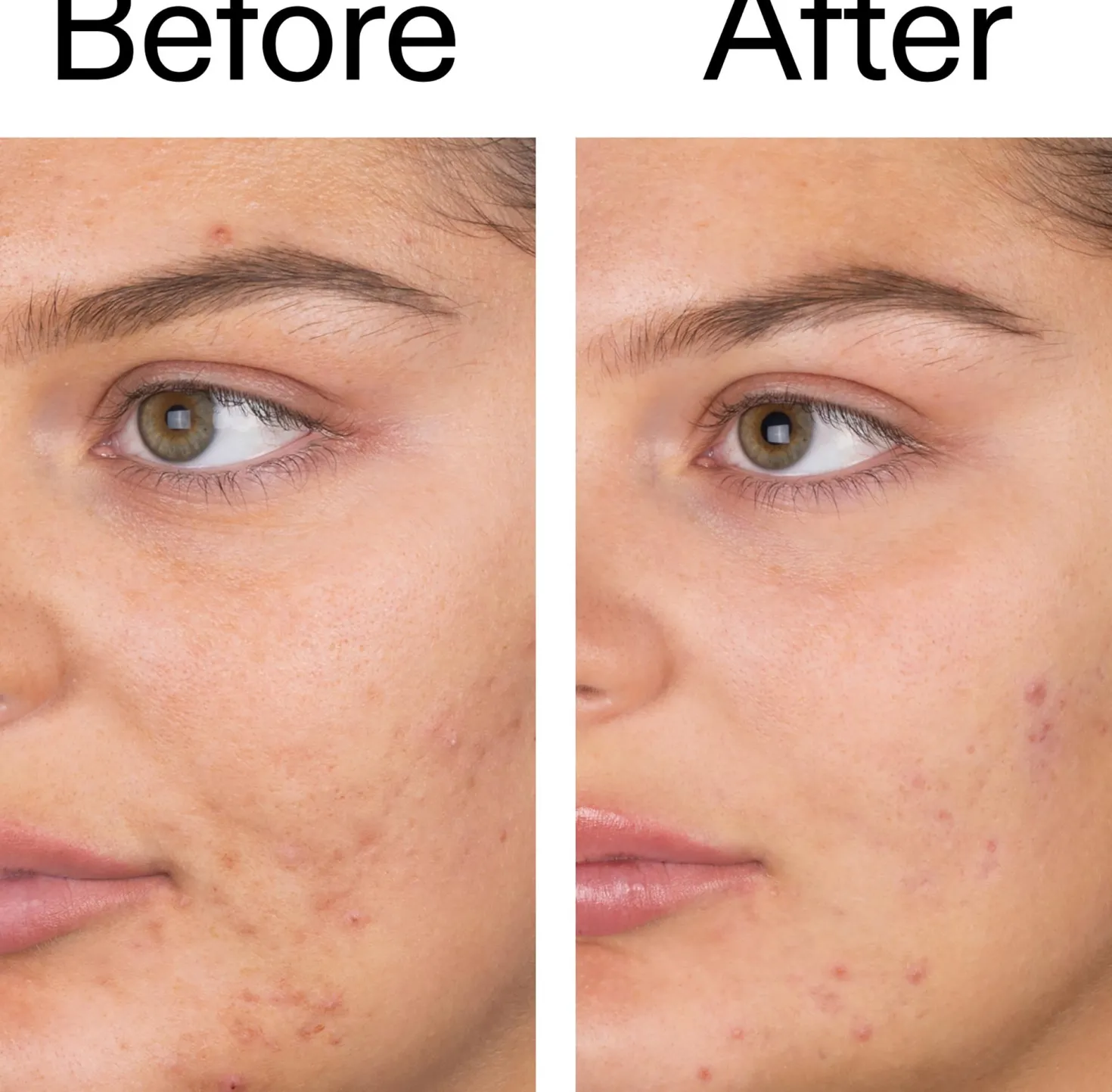 The Inkey List Salicylic Acid Cleanser 60 ml