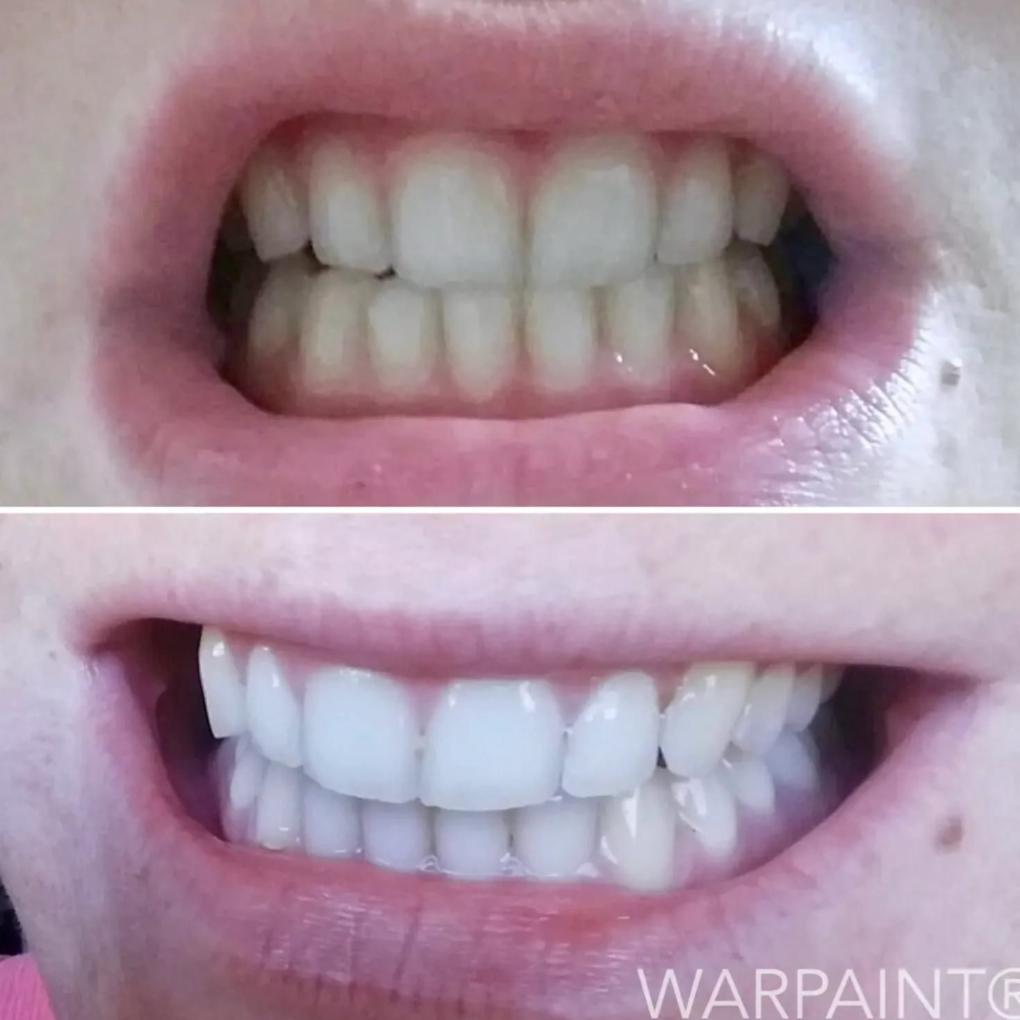 Warpaint Tandblekning 30 g