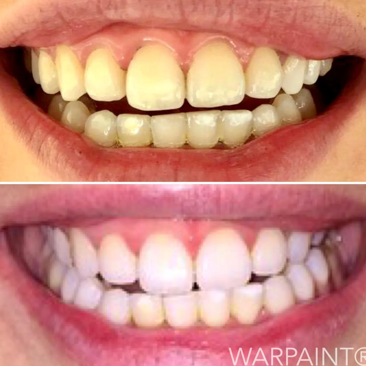 Warpaint Tandblekning 30 g